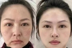 Foreign trade export OEM customized nutrit